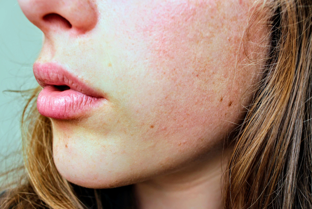 Why Are My Pores So Big? What Actually Helps